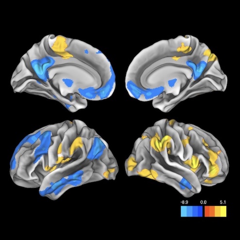 Brain